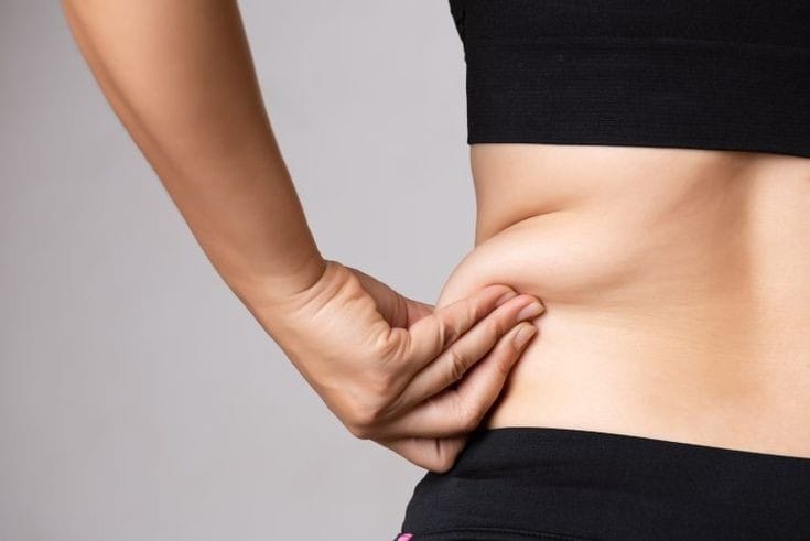 Woman pinching lower belly fat demonstrating results of weight loss liposuction treatment